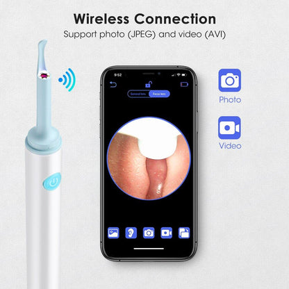 Neat Mini 3.9mm WiFi Visual Ear Spoon 5.0MP Otoscope Camera Endoscope!